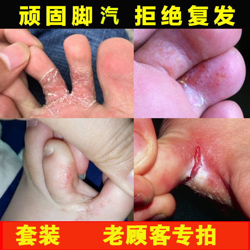 套装老顾客专拍