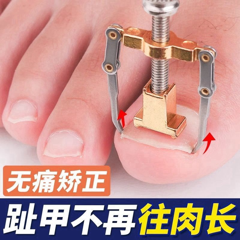 甲沟专用矫正器指甲剪刀嵌甲纠正贴工具修脚神器正甲垫矫正器