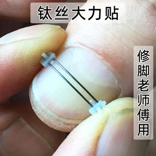 双丝镍钛合金正甲贴矫正钢丝甲沟嵌甲炎指甲贴修脚刀矫正器拉平痛