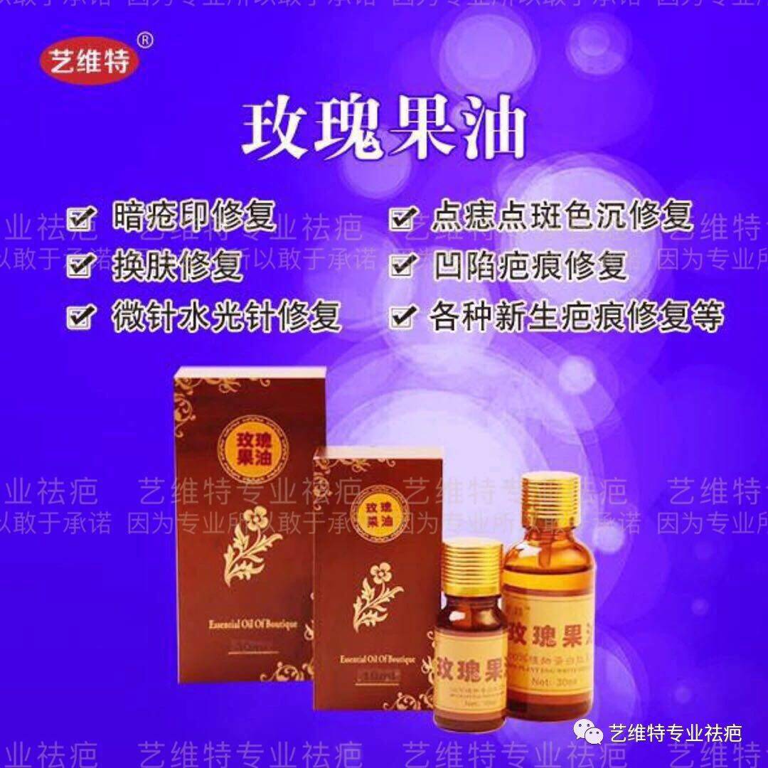 祛疤痕凹凸痘印双眼皮手术增生疤痕艺维特抑疤灵玫瑰果油