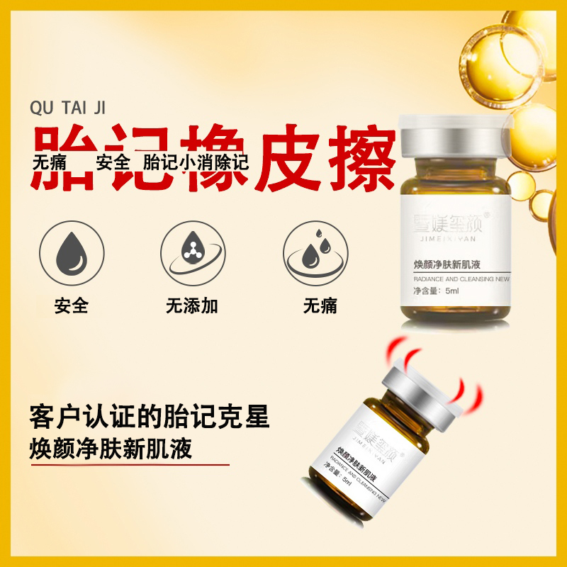 中国广州去除淡化胎记精华液神器