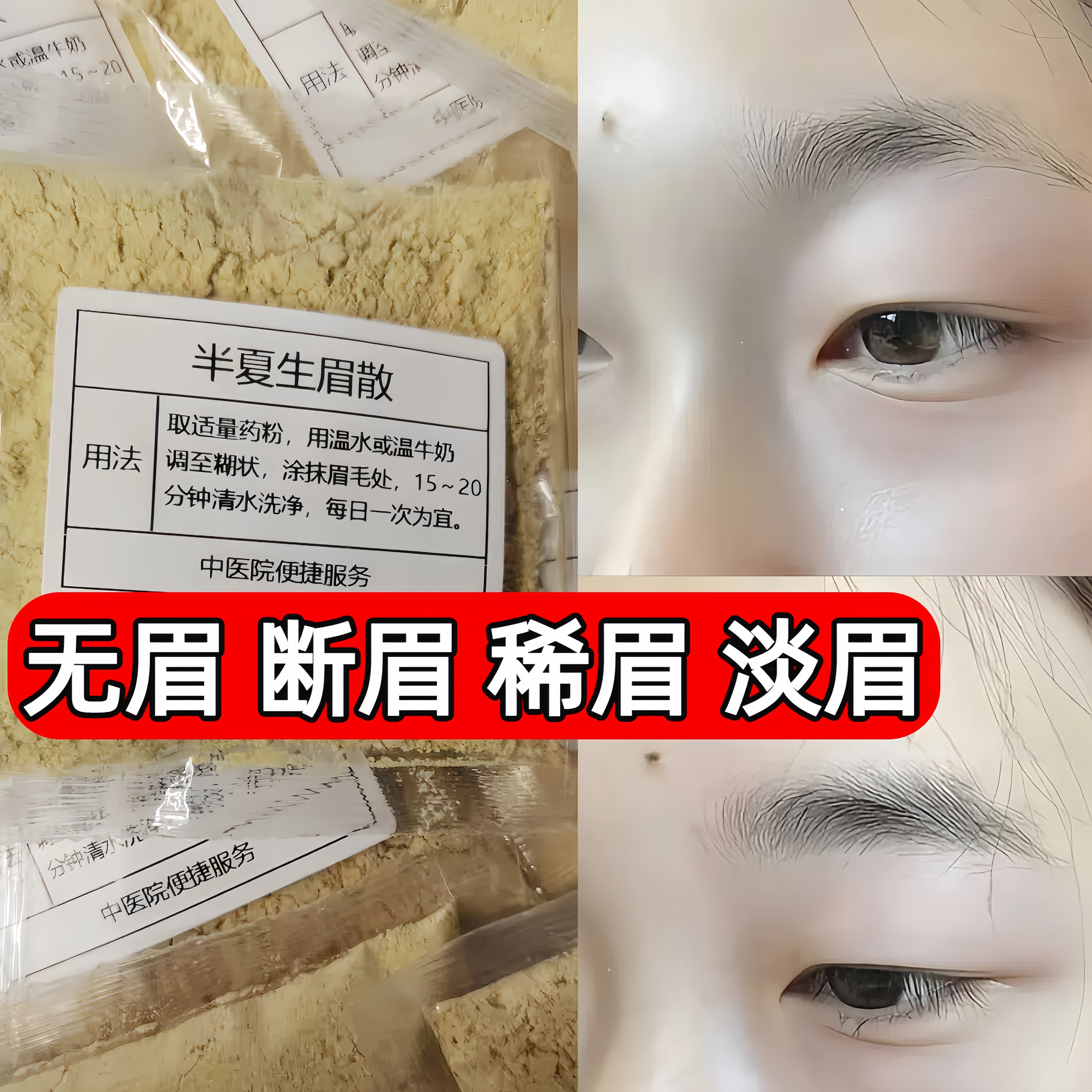杭州第一医院【半夏生眉散】眉毛稀疏 发际线少 增长 变浓 滋养