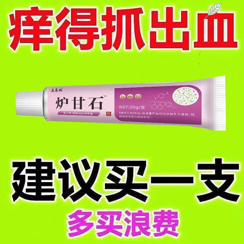 炉甘石草本皮肤瘙痒过敏发红蚊虫叮咬温和草本男女通用