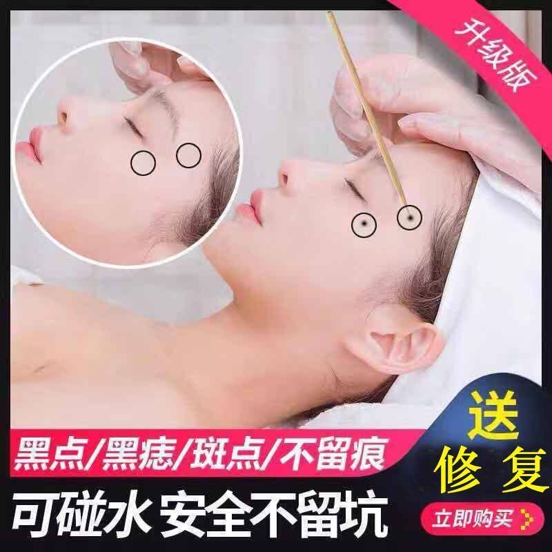 美容院点黑痣药水点斑去黑痣膏正品去肉痣祛雀斑黑痦子美容金水