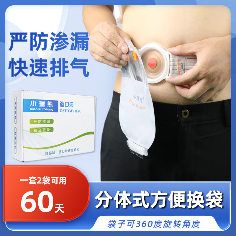 小瑞熊腰带式造口袋二件式直肠改道造瘘袋大便袋非粘贴肛肠道口袋