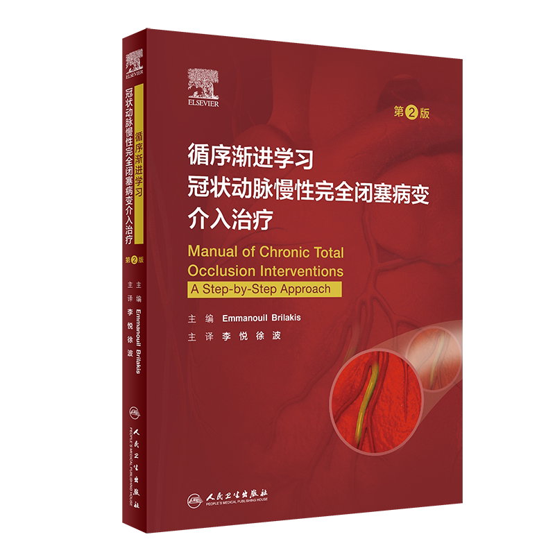 循序渐进学习冠状动脉慢性完全