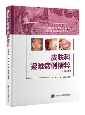 皮肤科疑难病例精粹 第4辑 何黎 王琳 刘彤云 红斑鳞丘疹鳞屑性肿瘤性等皮肤病发病机制临床诊疗 北京大学医学出版社9787565927409