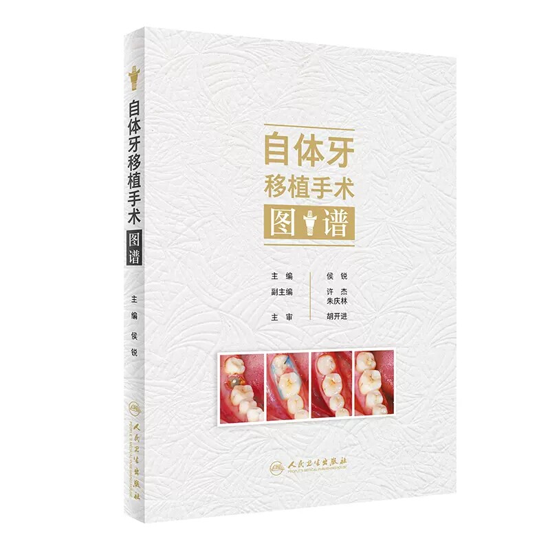 自体牙移植手术图口腔牙科手术