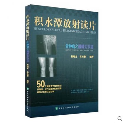 积水潭放射读片髋膝关节篇