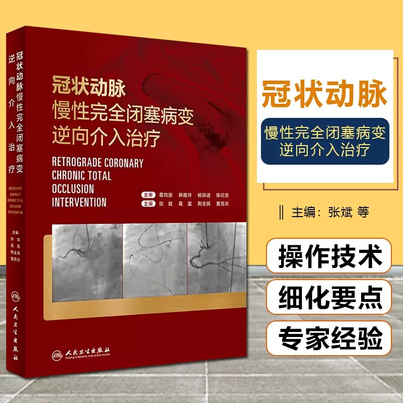 冠状动脉慢性完全闭塞病变逆向介