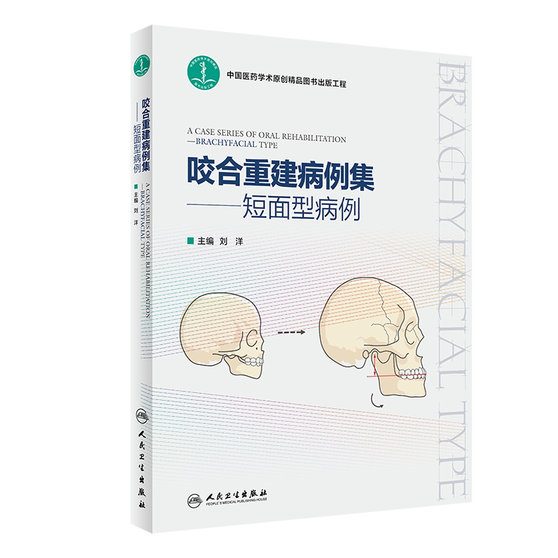 咬合重建病例集短面型