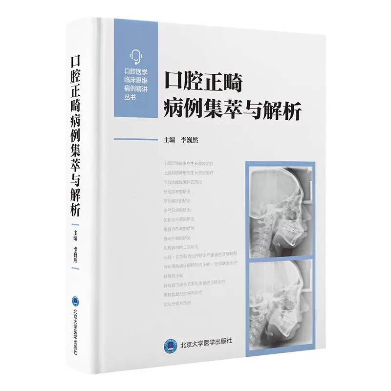 口腔正畸病例集萃与解析 李巍然主编 全面系统的对各类错 畸形的正畸治疗进行介绍 口腔学书籍 9787565934155 北京大学医学出版社