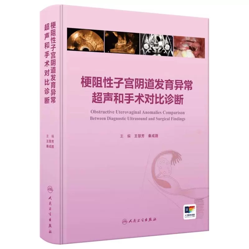 梗阻性子宫阴道发育异常超声