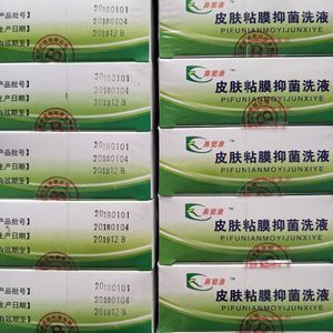 河北康灵鼻窦康皮肤粘膜抑菌洗液（B型）鼻病 鼻窦病 过敏性鼻病