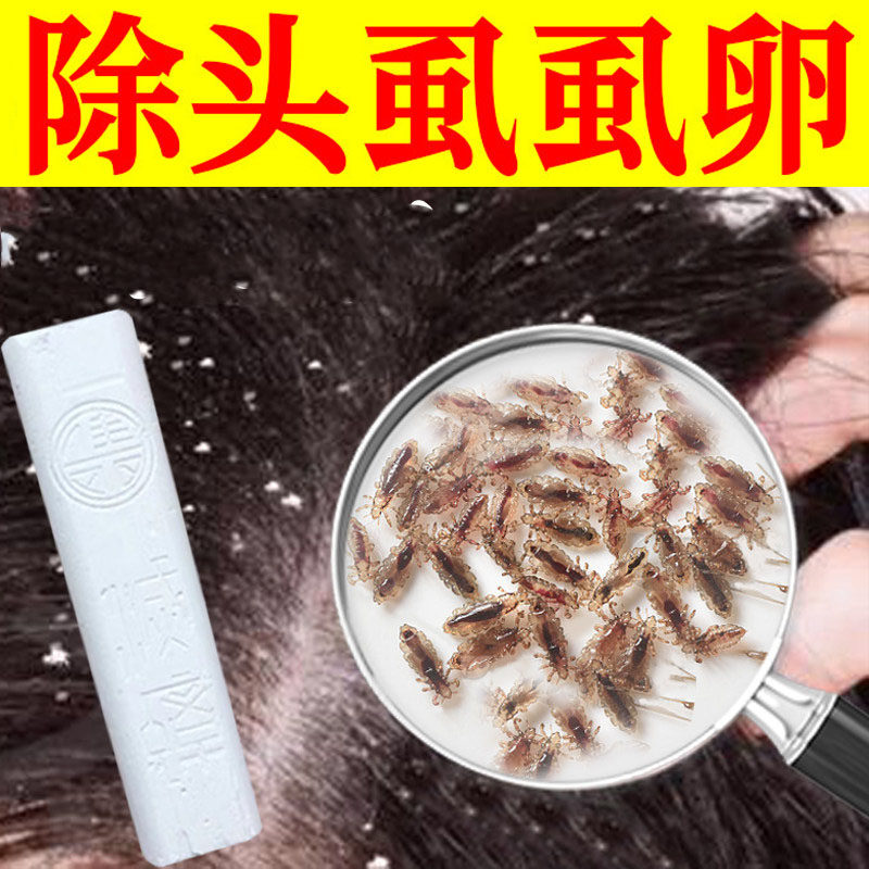 神奇药笔去头虱子药儿童虱子药头发虱立净去除虱卵百部酊灭头虱cq