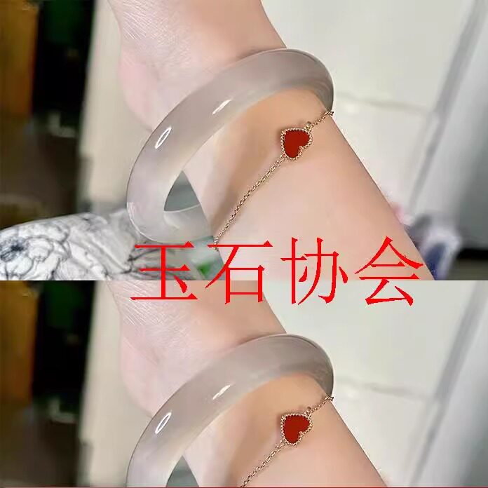 高端高冰种白月光荔枝冻玛瑙手镯少女款圆条玉髓玉镯高品质款处理