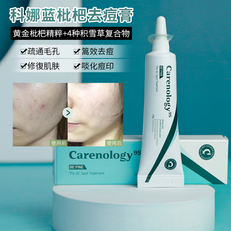 科娜蓝淡化痘印痘痘舒缓修护