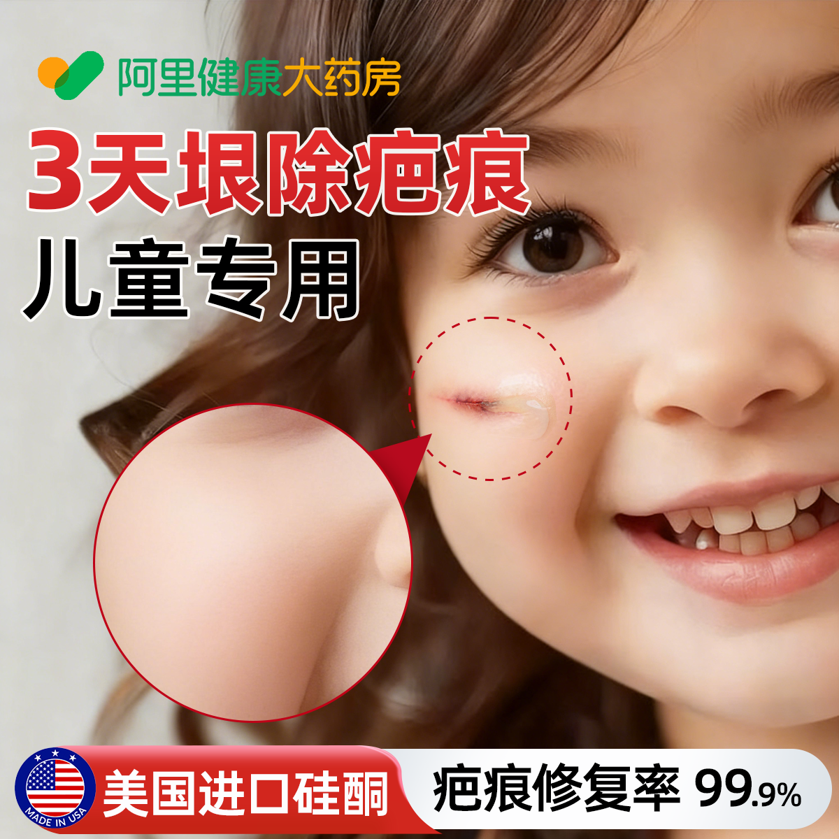 医用级祛疤膏儿童专用去除疤痕