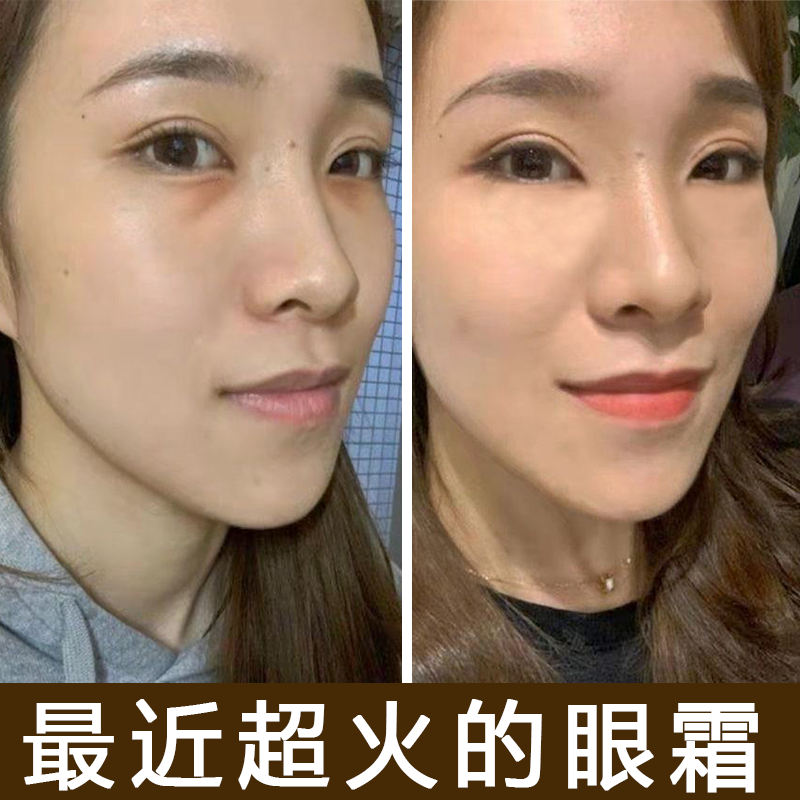 去除眼袋神器克星祛浮肿消脂肪粒淡化提拉紧致修复眼霜学生正品女