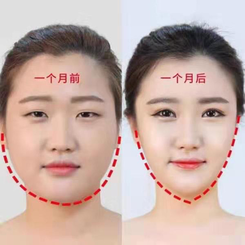 【小红书推荐 秒变瓜子脸】小脸神器 大脸不求人 三盒一疗程