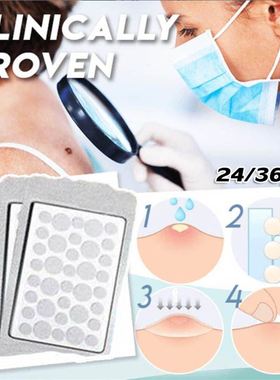 Skin Tag Remover Patch Pimple Wart Treatment Cream Quick Ab