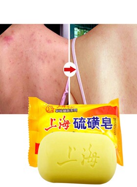 Sulfur Soap Acne Treatment Blackhead Remover Soap Whitening