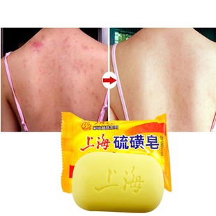 Sulfur Soap Acne Treatment Blackhead Remover Soap Whitening
