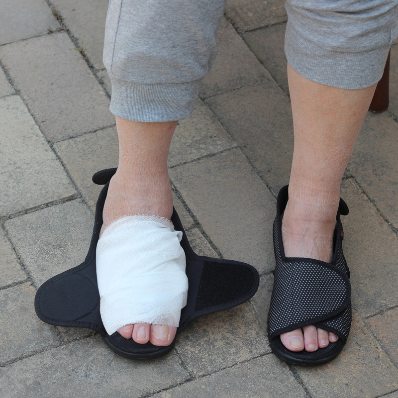 老人脚肿变形大脚骨痛风拇指外翻瘫痪糖病足术后专用调节加宽凉鞋
