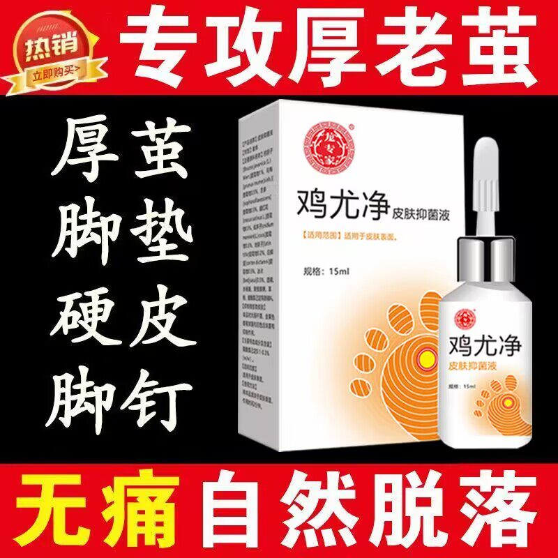 龙专家鸡尤净去鸡眼趾疣肉刺猴子扁平尤脚疣脚垫足部手部成膜药水