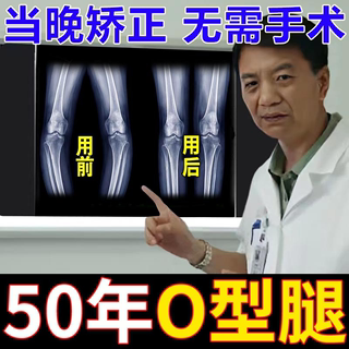 O型腿矫正神器小腿外翻矫正器改善X型腿罗圈腿内八腿矫正器专用贴