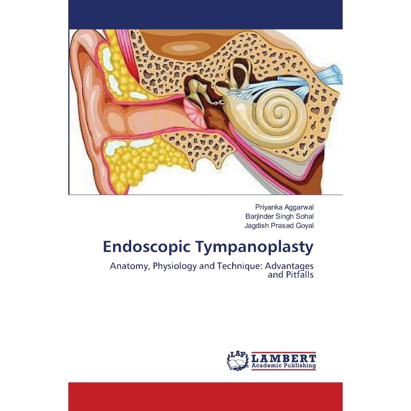 按需印刷不退不换Endoscopic Tympanoplasty[9783659363580]