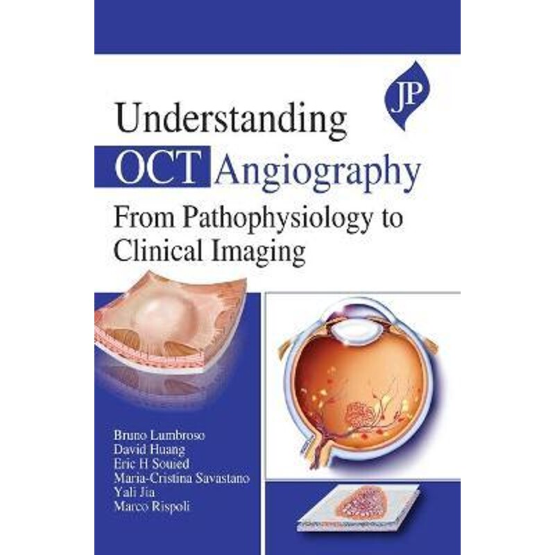 按需印刷不退不换UNDERSTANDING OCT ANGIOGRAPHY FROM PATHOPHYSIOLOGY TO CLINICAL IMAGING[9781909836938]