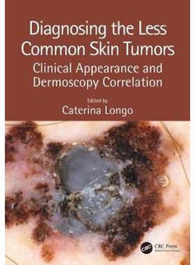 按需印刷不退不换Diagnosing the Less Common Skin Tumors:Clinical Appearance and Dermoscopy Correlation[9781138106628]