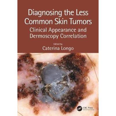按需印刷Diagnosing the Less Common Skin Tumors:Clinical Appearance and Dermoscopy Correlation[9781138106628]