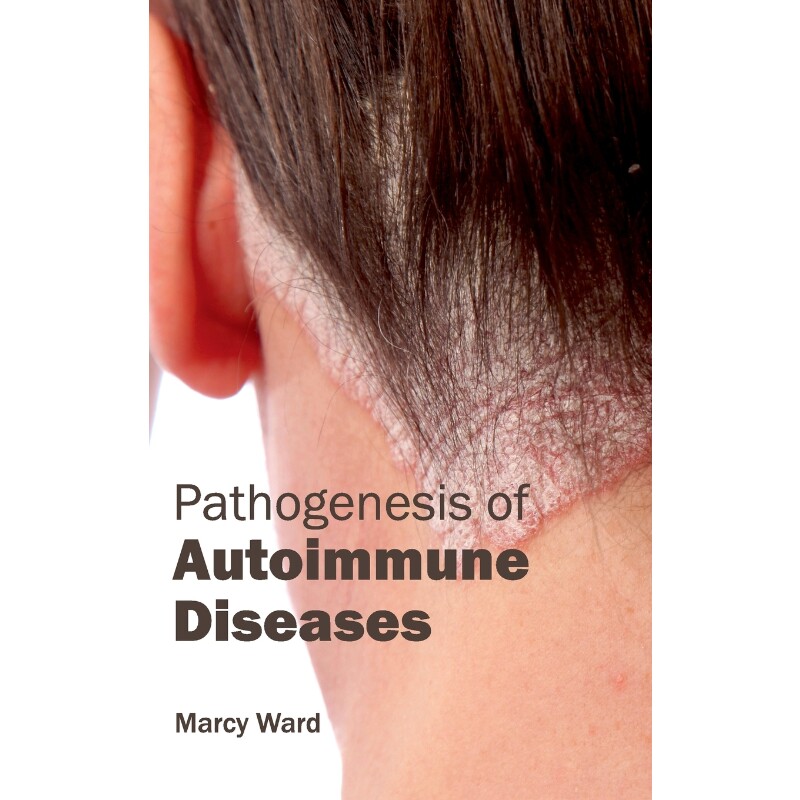 按需印刷不退不换Pathogenesis of Autoimmune Diseases[9781632413178]