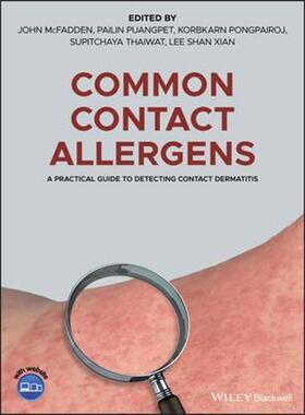 按需印刷不退不换Common Contact Allergens:A Practical Guide to Detecting Contact Dermatitis[9781119405665]