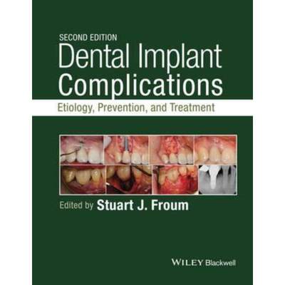 预订Dental Implant Complications:Etiology, Prevention, and Treatment