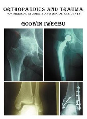 按需印刷不退不换Orthopaedics and Trauma for Medical Students and Junior Residents[9781477260951]