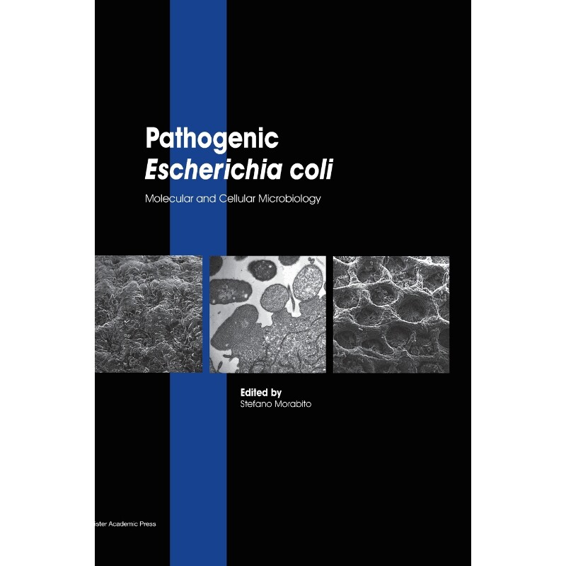 按需印刷不退不换Pathogenic Escherichia coli[9781908230379]