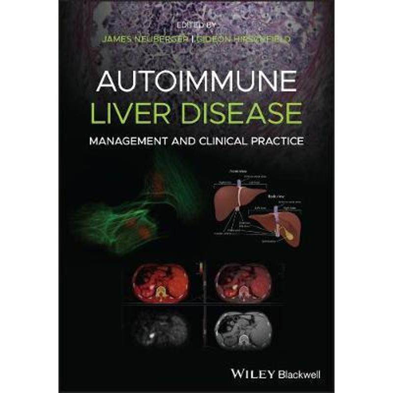 预订，下单后3-4周发货！