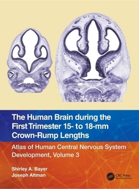 预订Human Brain during the First Trimester 15- to 18-mm Crown-Rump Lengths[9781032219288]