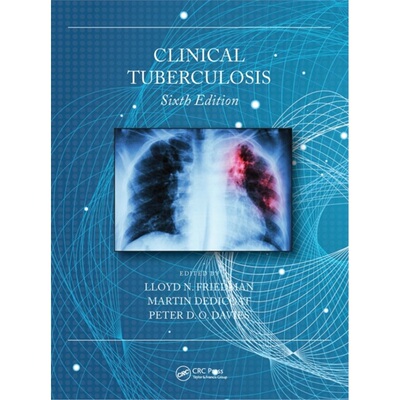 预订不退不换Clinical Tuberculosis[9780367529963]