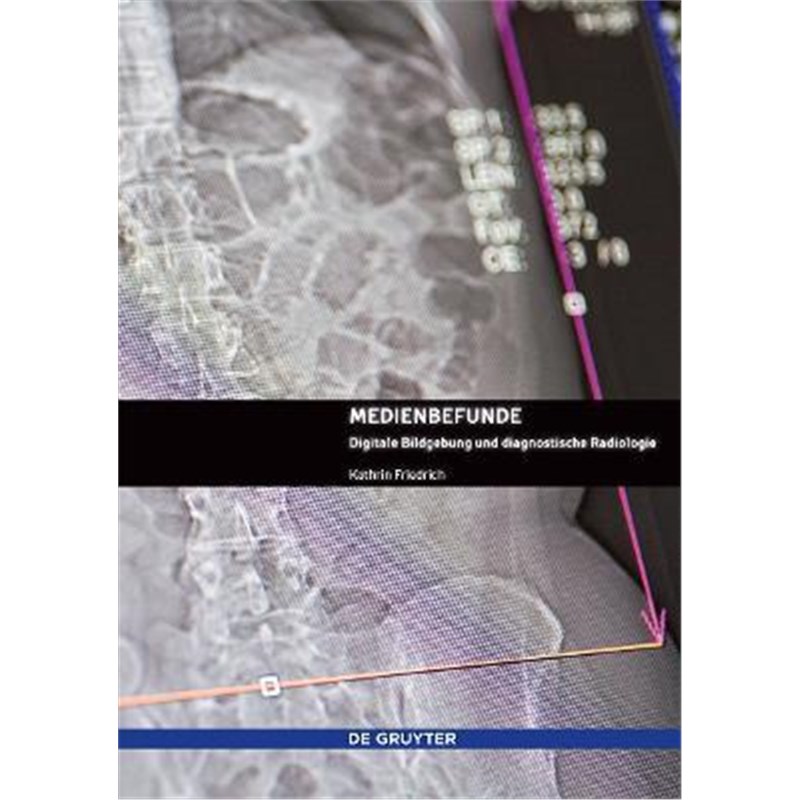 预订，预计下单后3-6周左右发货！