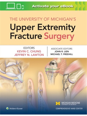 预订不退不换University of Michigan's Upper Extremity Fracture Surgery