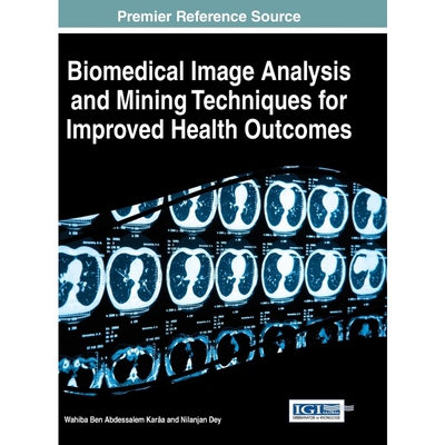 按需印刷不退不换Biomedical Image Analysis and Mining Techniques for Improved Health Outcomes[9781466688117]