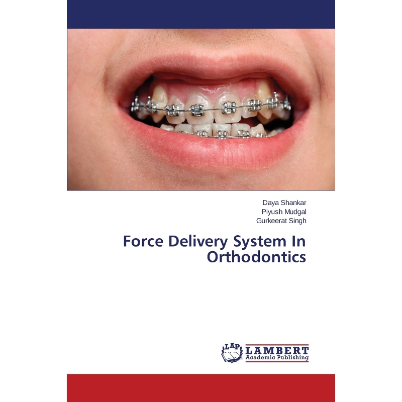 按需印刷Force Delivery System In Orthodontics[9783659801471]