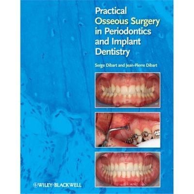 预订Practical Osseous Surgery in Periodontics and Implant Dentistry[9780813818122]