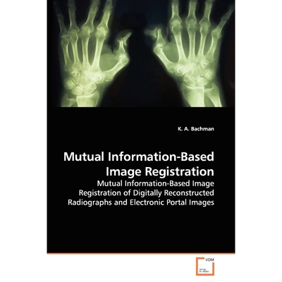 按需印刷Mutual Information-Based Image Registration[9783836484831]