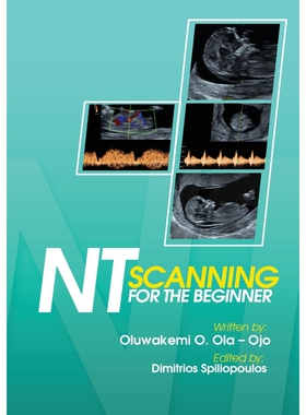 按需印刷不退不换NT Scanning for the Beginner[9781908015068]