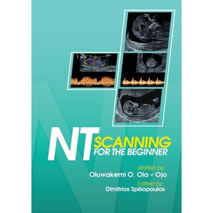 按需印刷NT Scanning for the Beginner[9781908015068]